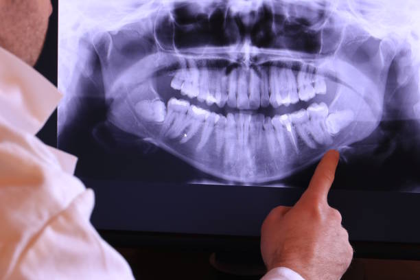 Best Emergency Treatment for Dental Infections or Abscesses in Drexel, OH